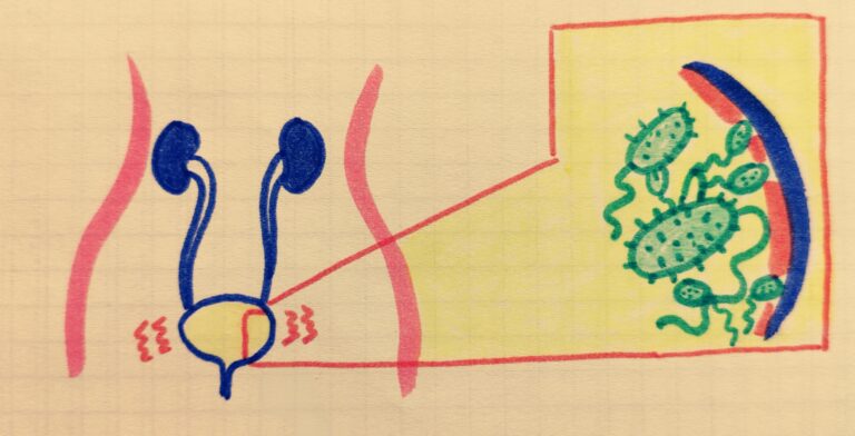 CISTITE POST-COITALE: come prevenirla e ritrovare la serenità?